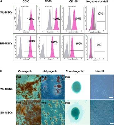 An In Vitro Comparison of Anti-Tumoral Potential of Wharton’s Jelly and Bone Marrow Mesenchymal Stem Cells Exhibited by Cell Cycle Arrest in Glioma Cells (U87MG)